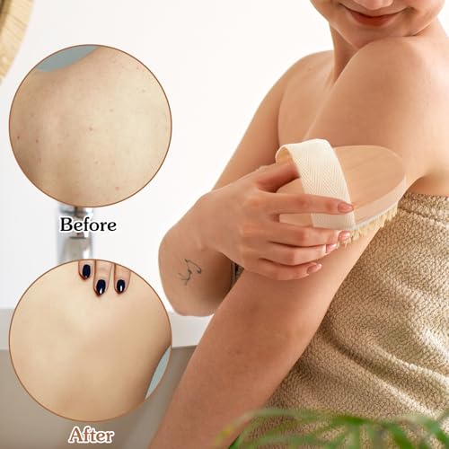 10 Pcs Dry Brushing Body Brush, Natural Bristle Exfoliating Brush Exfoliating Brushes with Massage Nodule Dry Skin Body Scrubber for Shower Blood Circulation, Deep Exfoliation for Smooth Skin