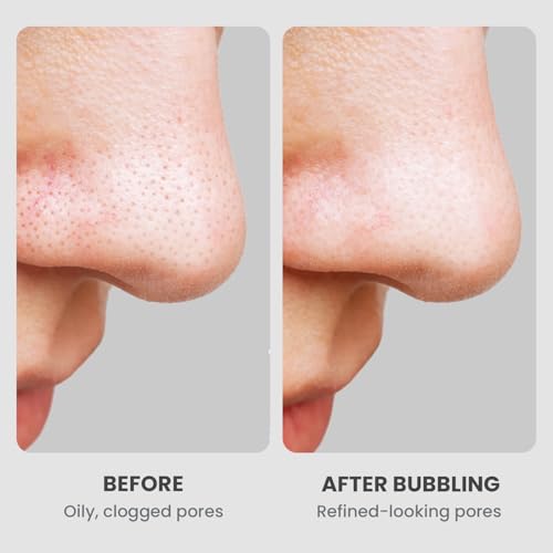 Carbonated Clay Mask for Face Deep Cleansing & Rejuvenation 135ml