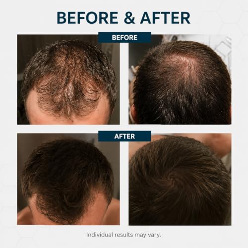 Volumizing Biotin Conditioner for Fine Hair - Lightweight & Thickening