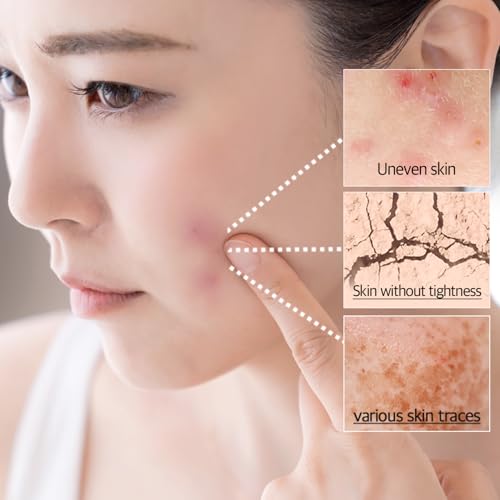 MedipickMe Centella Asiatica Soothing Gel Cream for Sensitive Skin – Fragrance-Free Moisturizer with Ceramide, Madecassoside, 68% Madagascar Extract
