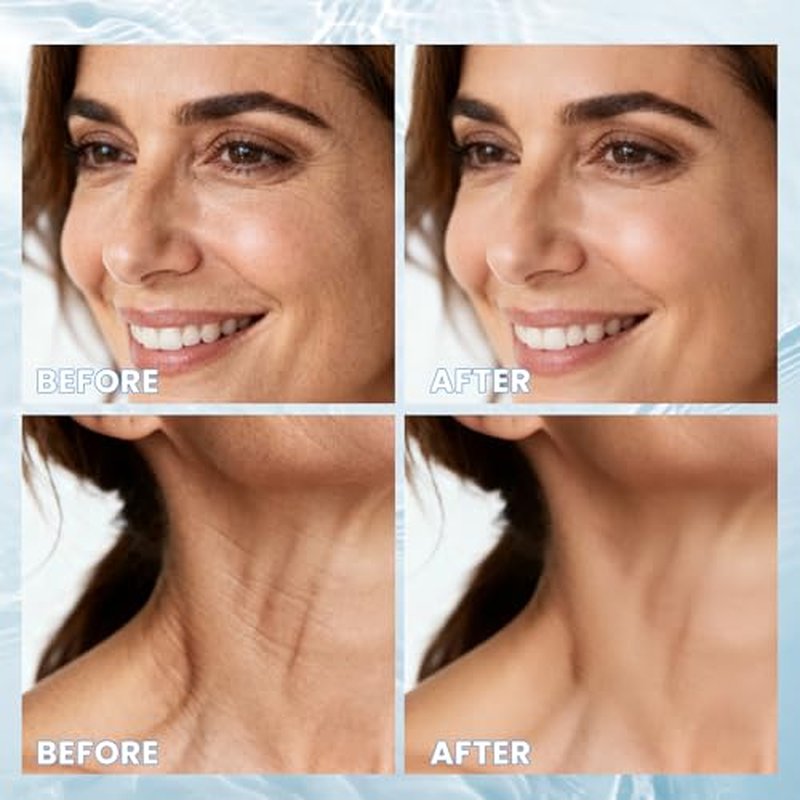 Micro Infusion System for Face - Microneedling Kit with Hyaluronic Acid & Collagen for Home Use - Moisturizing & Anti-Wrinkle Serum for All Skin Types,Christmas Gifts for Women- 2 Roller + 6 Serums