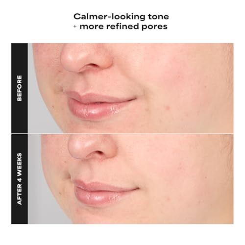 Paula's Choice 4% BHA Exfoliating Serum Toner for Clear & Smooth Skin, 1 fl oz