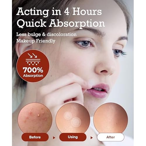 Zit Patches for Face - 2 Packs(Total 220 Dots) with 2 Popper Tools - Invisible Spot Clear Hydrocollopid patches