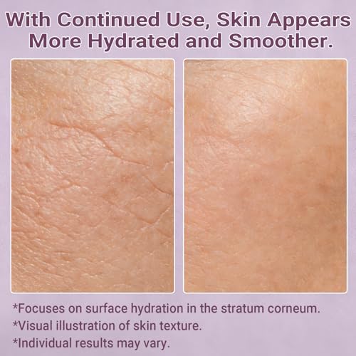 LANDISO NAD+ & Peptide Moisturizer with Hyaluronic Acid – 5 Botanical Extracts, Non-Greasy All-Day Hydration