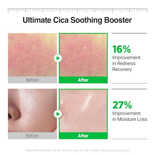 Calming Cica Face Serum - Soothing Trouble Skin Relief, 1.69 fl oz