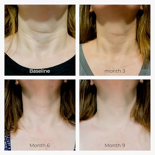 Neck Cream, Tighten & Lift Neck Cream - Anti-Aging Neck Creams for Tightening Lifting Sagging Skin and Hydrating- With Pro-Active Repair Firming Complex, 1.8 oz