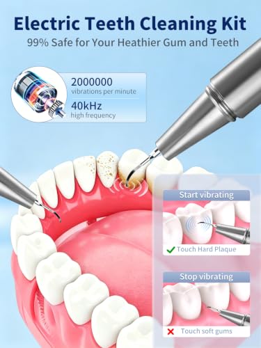 Teeth Plaque & Tartar Remover with HD Camera - Dental Cleaning Kit with LED Light & 5 Modes