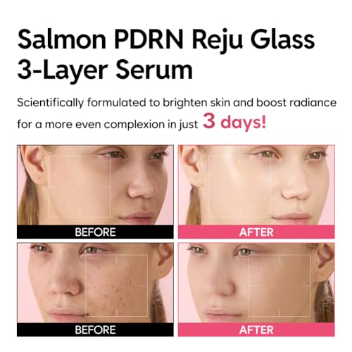 Salmon PDRN Serum for Glass Skin & Firming - 1.06 fl oz