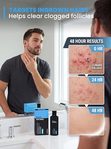 Bump Patrol Original Aftershave Serum Pack of 4 - Razor Bump Relief & Ingrown Hair Treatment, 2 oz Each