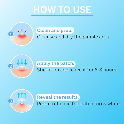 Pimple Patches for Face - Hydrocolloid Patches, Fast Healing, Ultra Thin Absorbing Cover, Skin Care, Spot Patches, Pimple Stickers, 2 Sizes (108 Count)