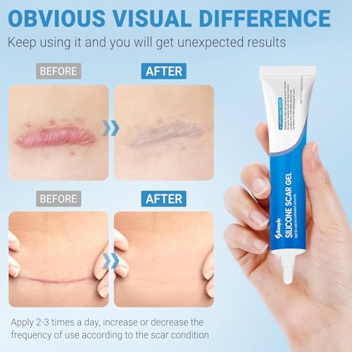 Silicone Scar Gel, Scar Cream, Advanced Scar Stick for Surgical Scars, Stretch Marks, Keloid Bump Removal, Old and New Scars 0.63oz (18g)