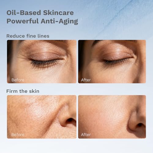 APoEM Renew Facial Serum Capsules (60 CT) ? Anti-Aging Oil-Based Skincare with Rosehip Oil, Musk Rose, & Damask Rose | Enhances Elasticity, Reduces Wrinkles, Nourishes & Moisturizes (0.81 Fl Oz)