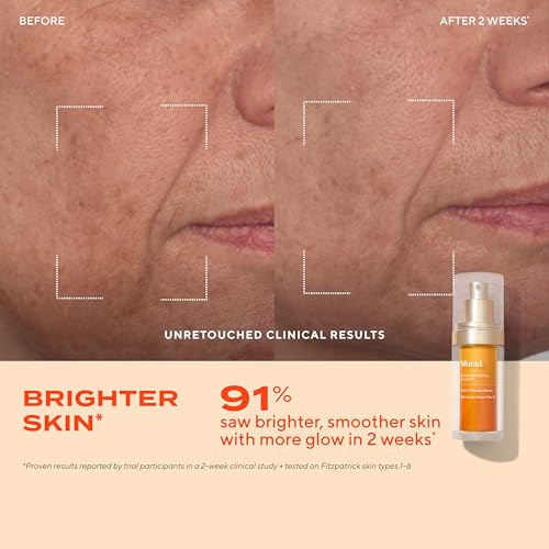 Murad Brighten Trial Kit ? Vitamin C Skincare Set for Brighten & Even Tone - Travel-Friendly Kit for Radiant, Even-Toned Skin