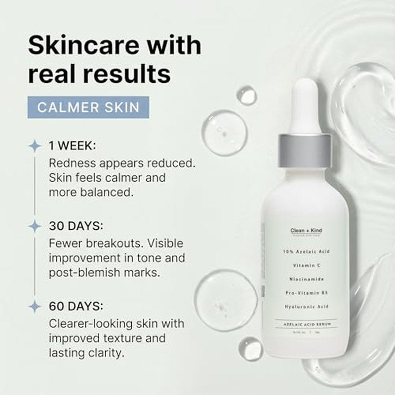 Azelaic Acid Serum with Niacinamide & Vitamin C ? Brightens Dark Spots, Reduces Redness, Helps Clear Acne Marks, Calms Sensitive Skin ? Lightweight Facial Serum