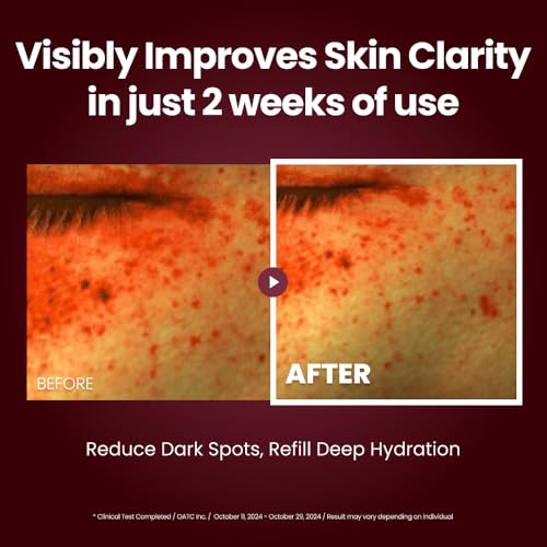Facial Moisturizer for All Skin Types - 1.69 Fl Oz Hydrating Cream