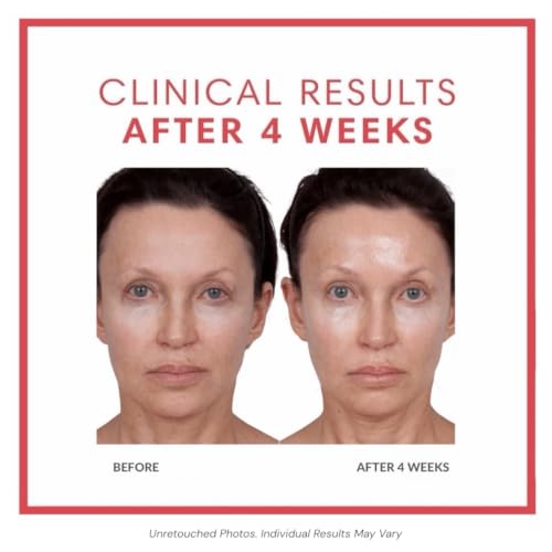 Collagen Eye Cream for Hydration and Firming - 0.5 oz