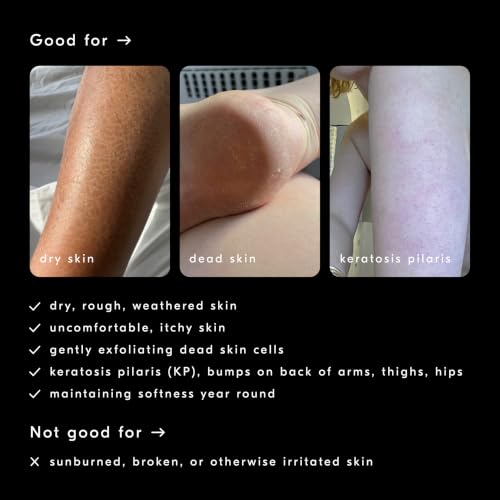 Soft Services Carea Cream Daily Body Lotion with Urea & Shea Butter - Fragrance-Free, Moisturizing & Exfoliating for Dry Skin