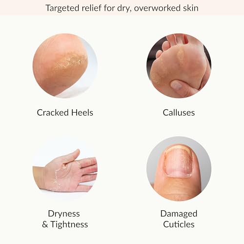 Epielle Hydrating & Moisturizing Hand & Foot Masks, Relieve and Soften Dry, Rough Skin, Self Care Gifts for Women, Spa Kit, Stocking Stuffers, 6 Moisturizing Gloves & 6 Moisturizing Socks
