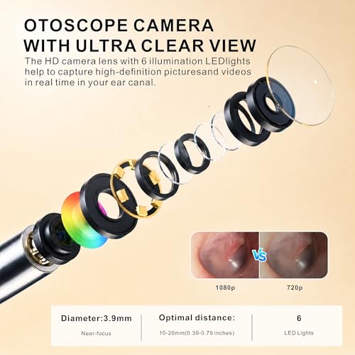 Digital Otoscope with 4.5-Inch HD Screen, No Phone Needed Ear Camera with Light