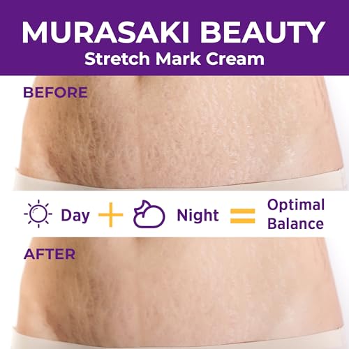 Stretch Mark Cream Prevention for Pregnancy - Maternity Cream 4 oz (120g)