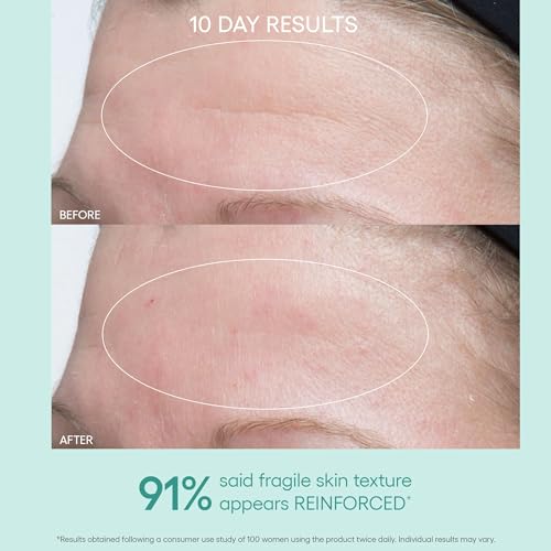 Algenist GENIUS Ultimate Anti-Aging Face & Neck Cream 2oz - Firming Moisturizer with Alguronic Acid & Microalgae Oil - Daily Skin Revitalizer