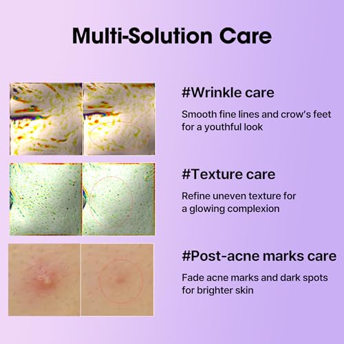 SOME BY MI Retinol Intense Reactivating Serum ? 1.69oz, 50ml ? Korean Bakuchiol Retinol Serum for Face Firming ? Improves Signs of Aging, Minimizes Pore Size & Refines Skin Texture ? Korean Skin Care