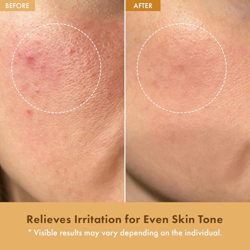 Hydrating Rice Cream for Skin Barrier Repair & Glow - 42% Rice Bran Water