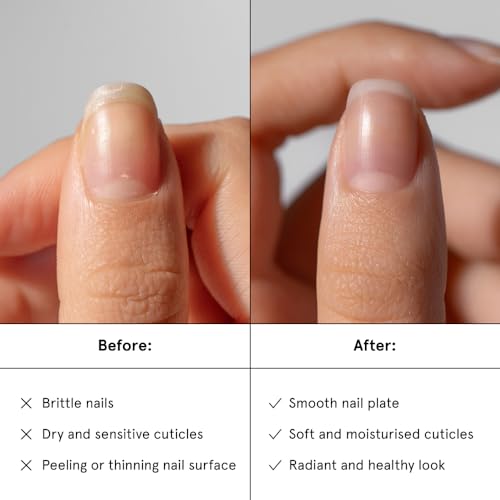 Nail Recovery Serum - Restoring Vegan Nail Strengthener - 0.5 Fl Oz