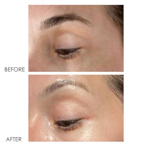 Dermelect Revitalite Eyelid & Dark Circle Corrector- Professional Strength, Anti-Aging Eye Cream with Peptides, Brightening & Tightening Ingredients- Dark Circles, Puffiness, Droopy Eyelids & Wrinkles
