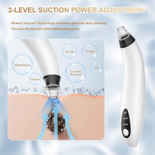 Blackhead Remover Vacuum Tool - Electric Pore Cleaner with Adjustable Suction (White)