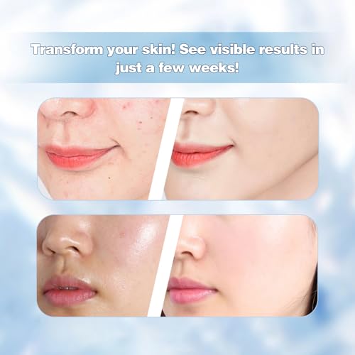 Corrector Cream with Hyaluronic Acid, Vitamin C, Niacinamide & 45% Multi-Action Concentrate - Reduces Fine Lines & Acne Scars for Smooth, Milk-Like Skin - 1.86 oz
