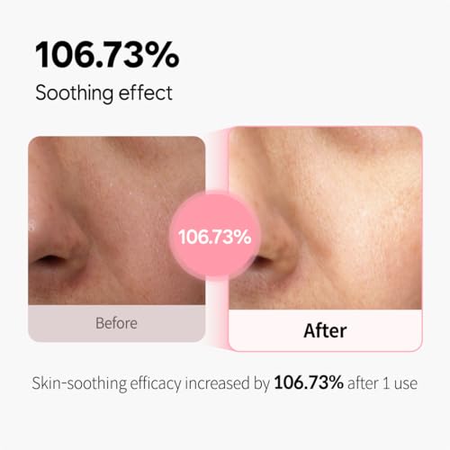 Hydrating Facial Toner with Niacinamide & Dragon Blood for Sensitive Skin