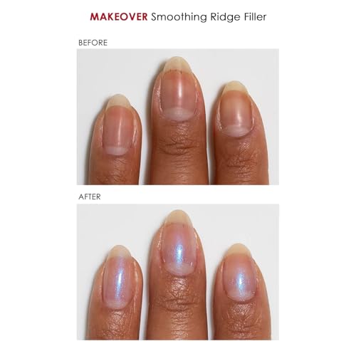 Dermelect Nail Renewal Kit – Ridge Filler & Brightener, Polishing Remover Wipes