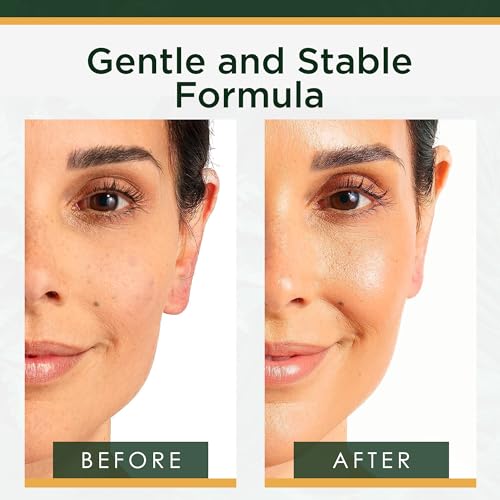 Vitamin C Serum for Face - 1 Fl Oz Pack of 2 - Dark Spots & Brightening