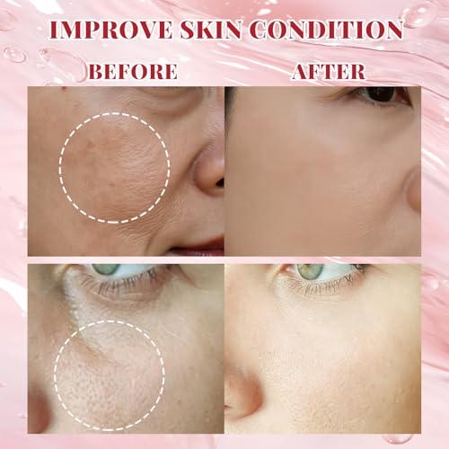 Micro Infusion System, Moisturizing Serum with PDRN & Peptides, Elegant Gift Packaging, Gift for Women,1 Roller + 3 Serums