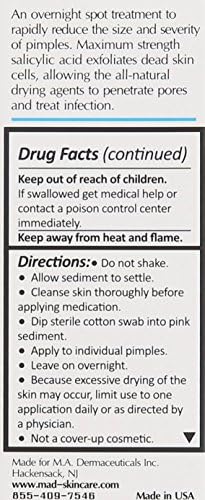 Acne Spot Treatment - 10% Sulfur & Salicylic Acid, Drying Lotion, 1 Fl Oz - Pack of 1