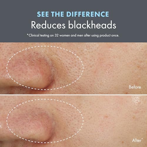 Origins Clear Improvement Blackhead Clearing Face Mask & Scrub | Reduces Blackheads | With Salicylic Acid & Bamboo Charcoal, 2.5 Fl Oz