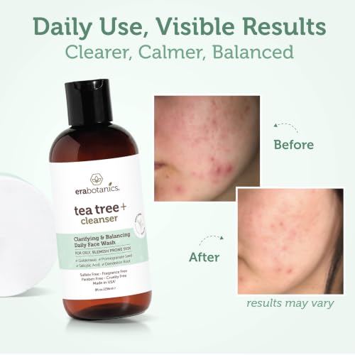 Tea Tree Oil Face Wash with Salicylic Acid for Oily Skin - Natural & Gentle Cleansing
