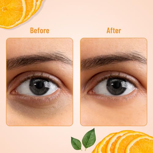 Anti-Wrinkle Eye Serum Patches for Dark Circles & Fine Lines - Collagen & Aloe Vera, 60 Pcs
