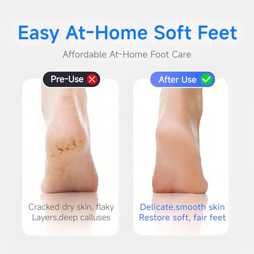 Rechargeable Electric Foot Callus Remover with 3-Speed & Stainless Steel Head