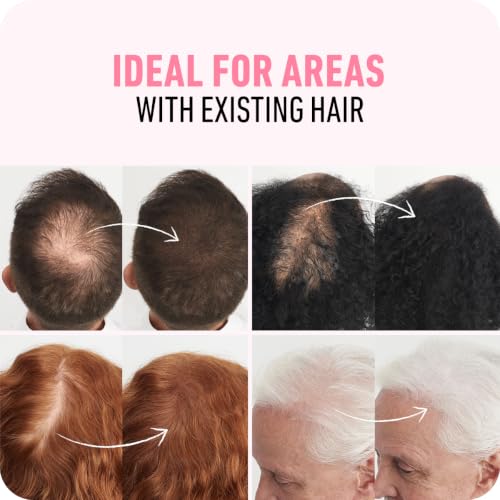 Boldify Hair Fibers for Thinning Hair - Dark Brown, 28g - Instant Volume & Concealer