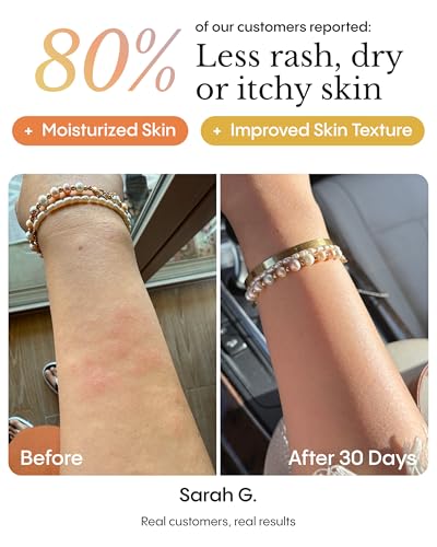 Dry & Itchy Skin Soothing Balm for Body & Face - Natural Relief, 3.4 fl oz
