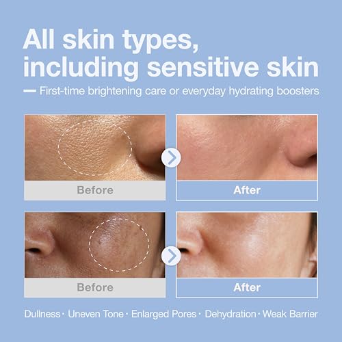 Niacinamide + Hyaluronic Brightening Deep Dive Serum,10% Brightening Complex, Deep Hydration Glow & Smooth Texture, Fragrance-Free, 30ml(1.01 fl oz)