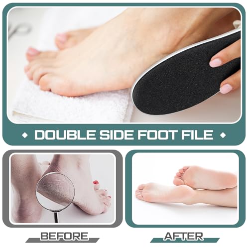 Lothee 30 Pack Double Sided Foot File Callus Remover - Pedicure Tool for Dead Skin & Cracked Heels, White, Variation 30