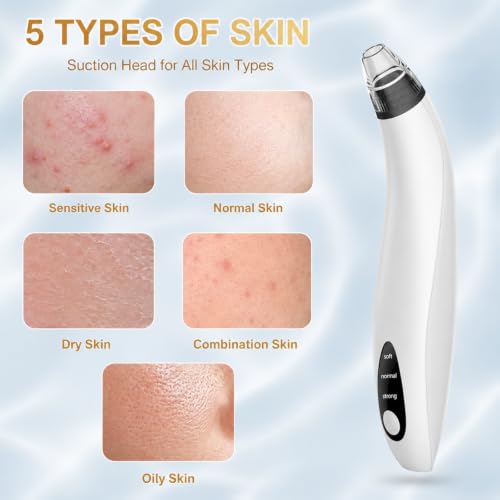 Blackhead Remover Vacuum Tool - Electric Pore Cleaner with Adjustable Suction (White)