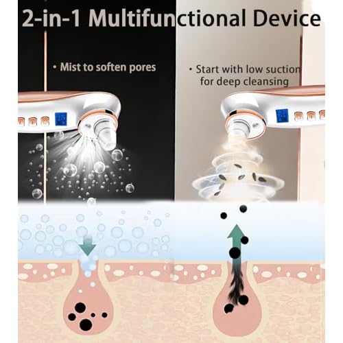 Blackhead Remover Pore Vacuum, Pore Cleaner for Face with 5 Attachments & 3 Suction Levels, USB Rechargeable Facial Blackhead Extractor Tool (Gold)