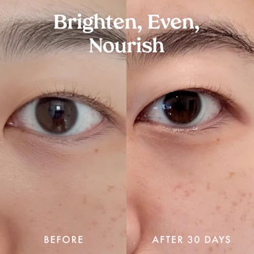 Kopari Ceramide & Retinol Dual-Core Eye Balm ? Targets Fine Lines, Texture & Puffiness with Encapsulated Retinol, Ceramides & Squalane ? Hydrating, Brightening, Anti-Aging Under Eye Treatment