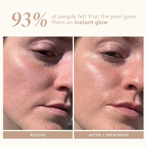 SHANI DARDEN SKIN CARE Triple Acid Peel, 2-Step Exfoliating Face Peel with Mandelic, Lactic & Glycolic Acids, Kaolin Clay Neutralizing Mask & Brush, Helps Improve Dark Spots & Skin Texture, 0.5 fl oz