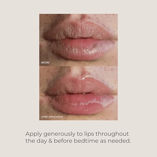 REFLEKT Restorative Lip Balm ? Daily Lip Treatment for Instrant Hydration, Smooth Fine Lines, Enhance and Plump Lips. With Squalanea and Hyaluronic Acid. Vegan, Cruelty-Free, Fragrance & Paraben-Free