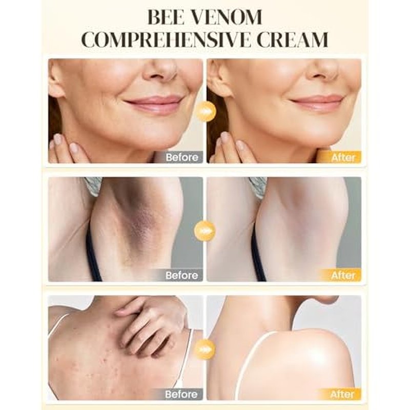 Bee Venom Moisturizing Cream, All-in-One Nourishing Moisturizer with Hyaluronic Acid, Firming & Hydrating Face and Body Cream, Natural Gentle Formula for All Skin Types (50g * 2PCS)